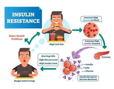 insulino resistenza dieta