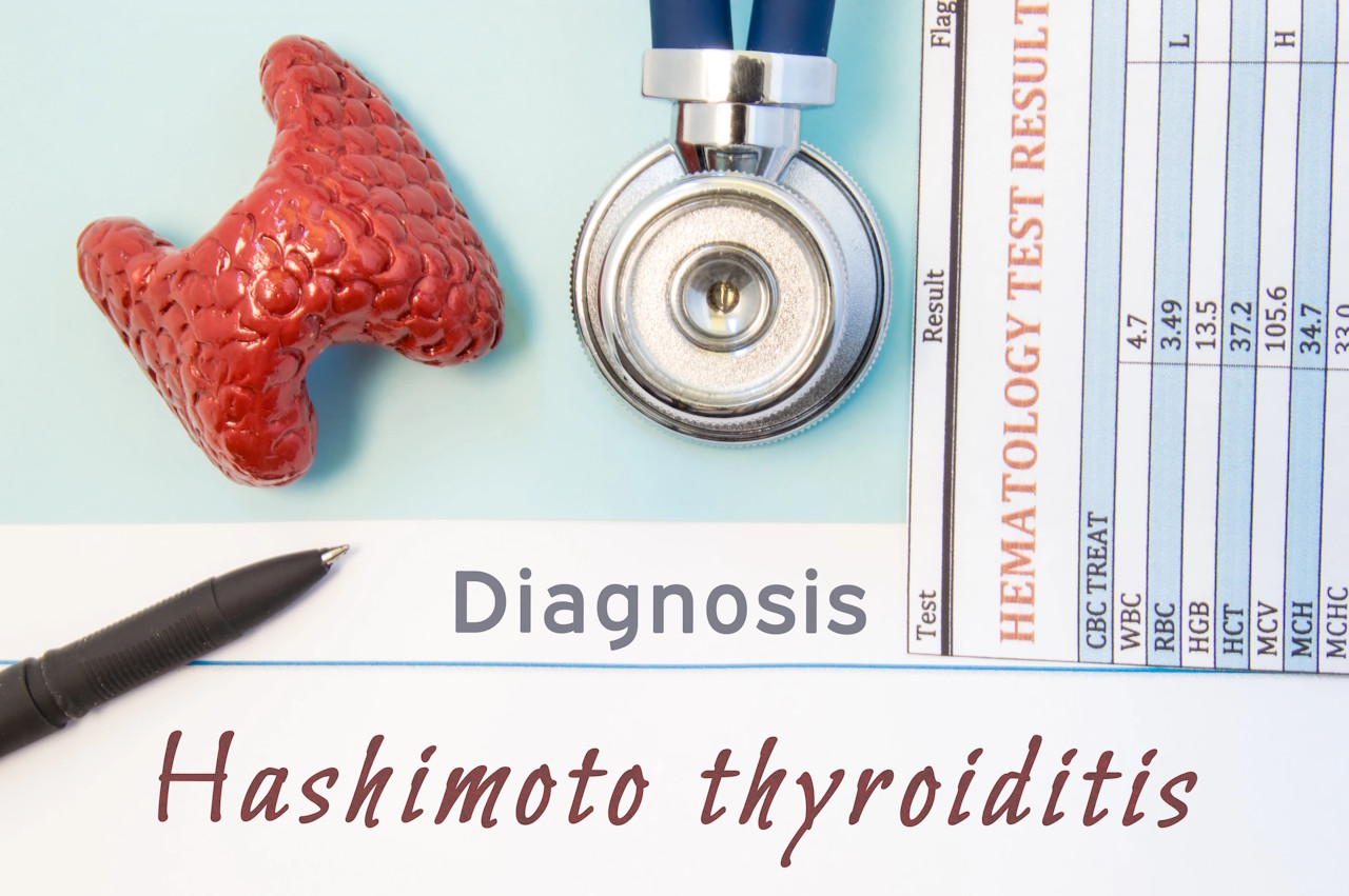 Tiroidite di Hashimoto: Dieta e Alimentazione
