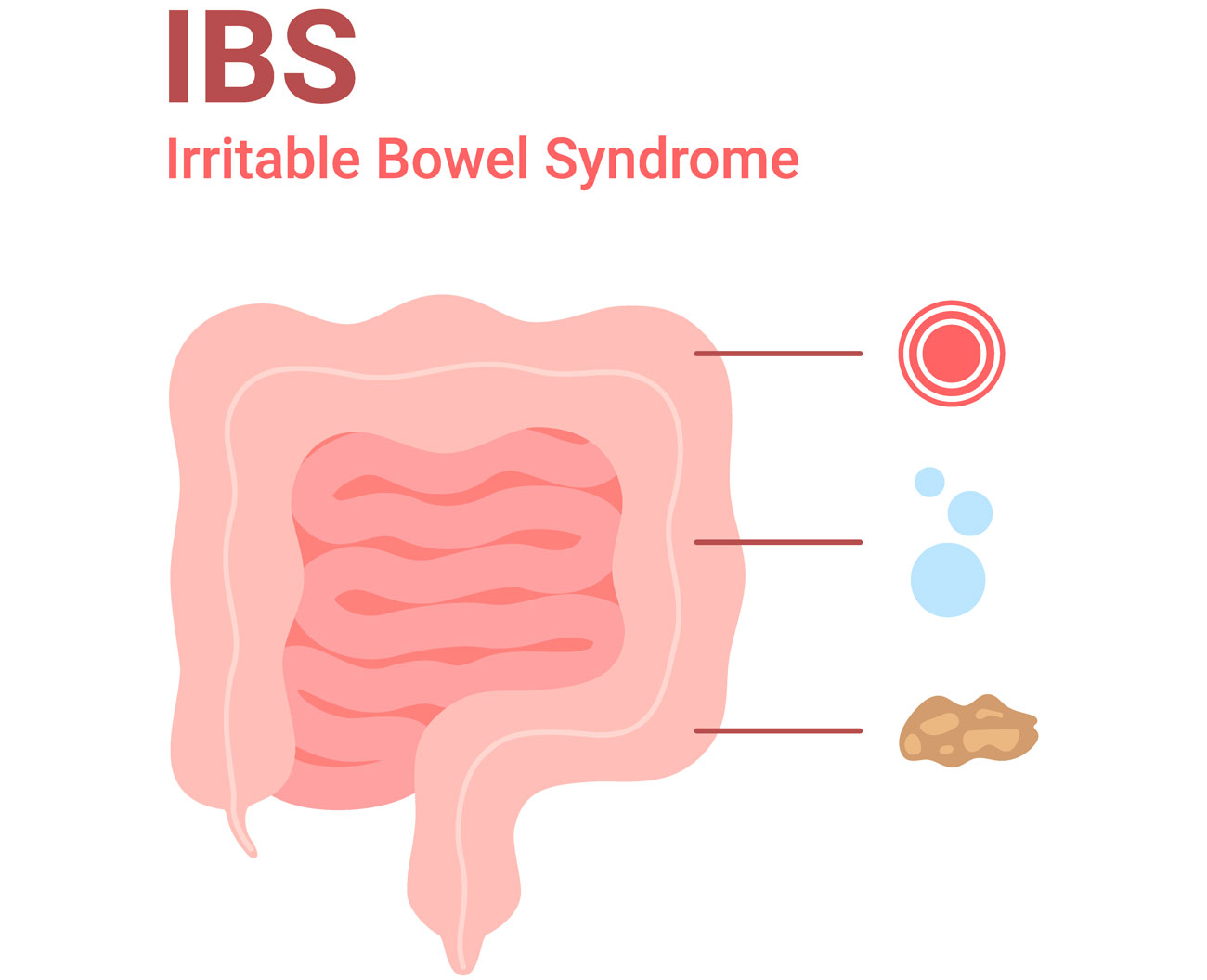 Rimedi colon irritabile IBS